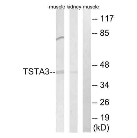 Western Blot - Anti-TSTA3 Antibody (C15900) - Antibodies.com