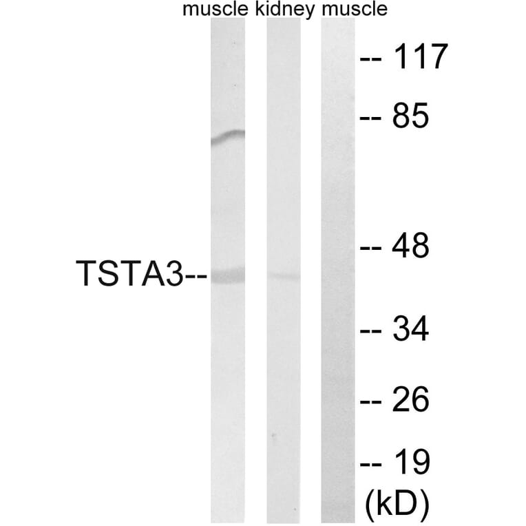 Western Blot - Anti-TSTA3 Antibody (C15900) - Antibodies.com
