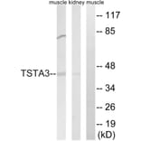 Western Blot - Anti-TSTA3 Antibody (C15900) - Antibodies.com