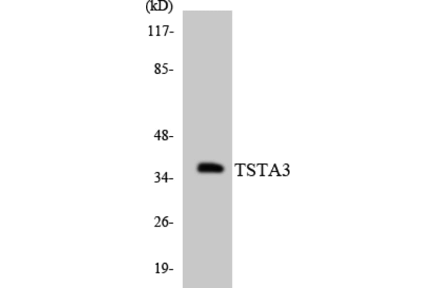 Western Blot - Anti-TSTA3 Antibody (R12-3656) - Antibodies.com