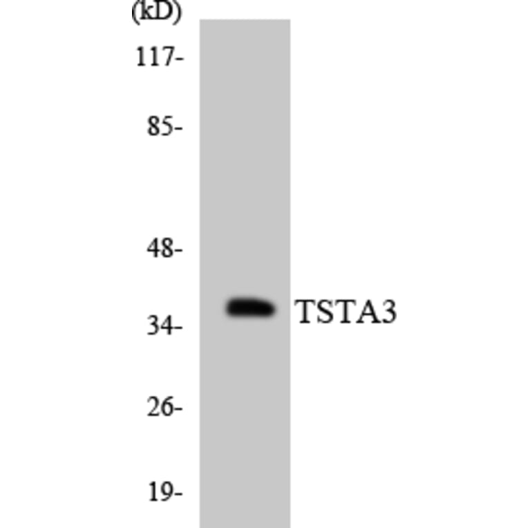Western Blot - Anti-TSTA3 Antibody (R12-3656) - Antibodies.com