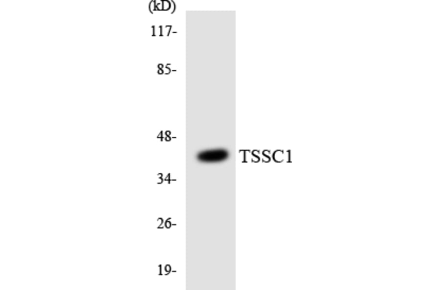 Western Blot - Anti-TSSC1 Antibody (R12-3654) - Antibodies.com