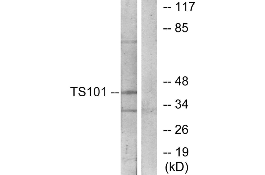 Western Blot - Anti-TS101 Antibody (C11576) - Antibodies.com