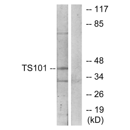 Western Blot - Anti-TS101 Antibody (C11576) - Antibodies.com