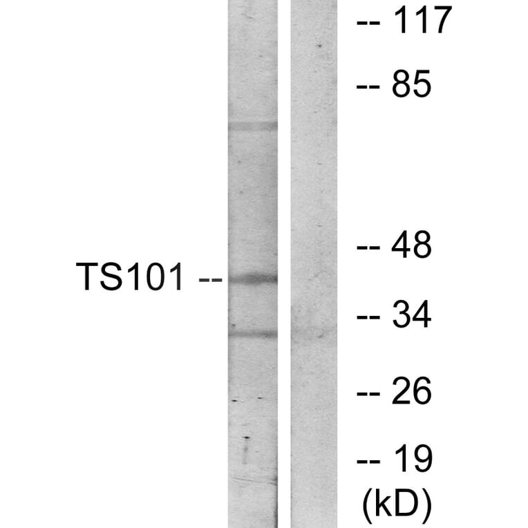 Western Blot - Anti-TS101 Antibody (C11576) - Antibodies.com