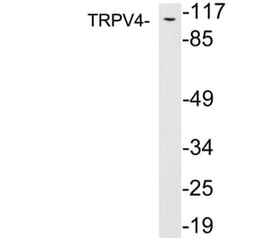 Western Blot - Anti-TRPV4 Antibody (R12-2393) - Antibodies.com