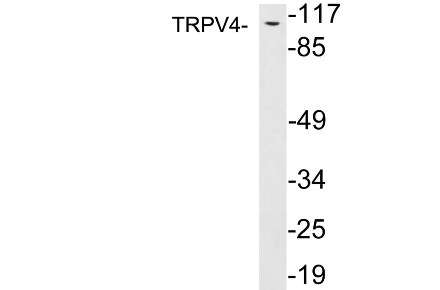 Western Blot - Anti-TRPV4 Antibody (R12-2393) - Antibodies.com
