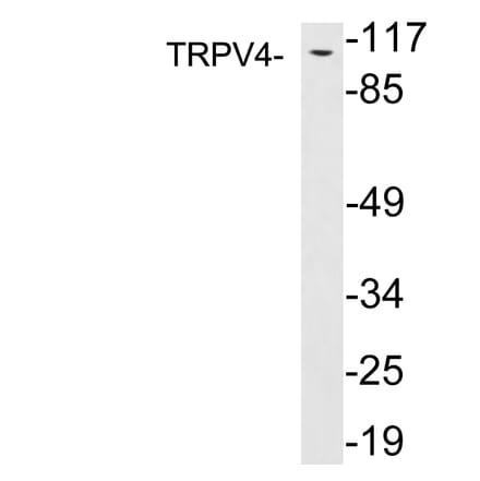 Western Blot - Anti-TRPV4 Antibody (R12-2393) - Antibodies.com