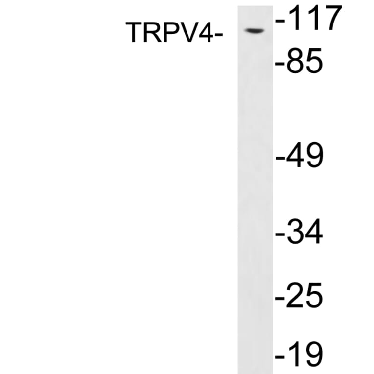 Western Blot - Anti-TRPV4 Antibody (R12-2393) - Antibodies.com