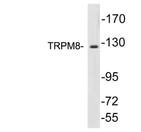 Western Blot - Anti-TRPM8 Antibody (R12-2392) - Antibodies.com