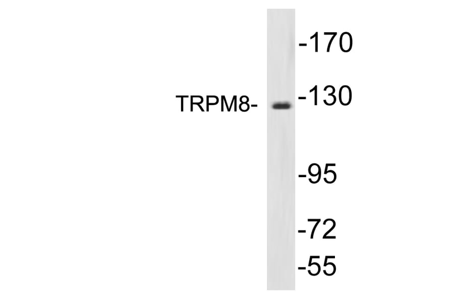 Western Blot - Anti-TRPM8 Antibody (R12-2392) - Antibodies.com