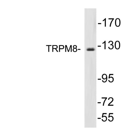 Western Blot - Anti-TRPM8 Antibody (R12-2392) - Antibodies.com