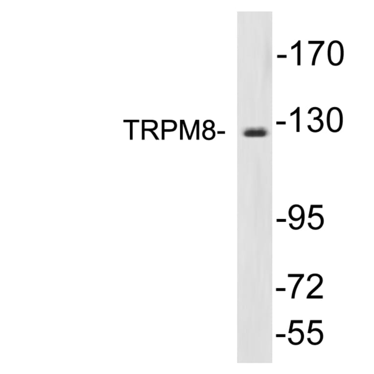 Western Blot - Anti-TRPM8 Antibody (R12-2392) - Antibodies.com