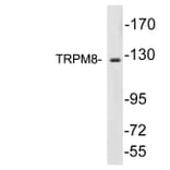 Western Blot - Anti-TRPM8 Antibody (R12-2392) - Antibodies.com