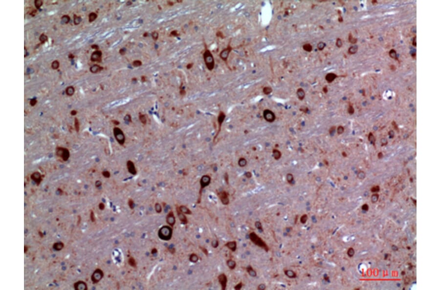 Immunohistochemistry - Anti-TRPC3 Antibody (C30186) - Antibodies.com