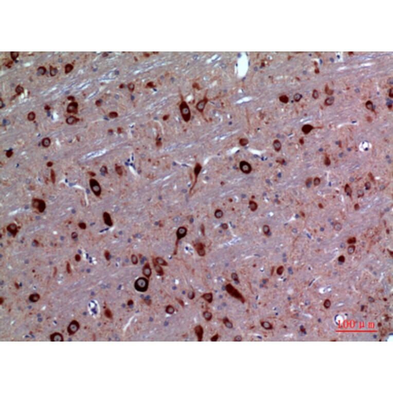 Immunohistochemistry - Anti-TRPC3 Antibody (C30186) - Antibodies.com
