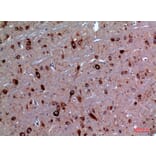 Immunohistochemistry - Anti-TRPC3 Antibody (C30186) - Antibodies.com