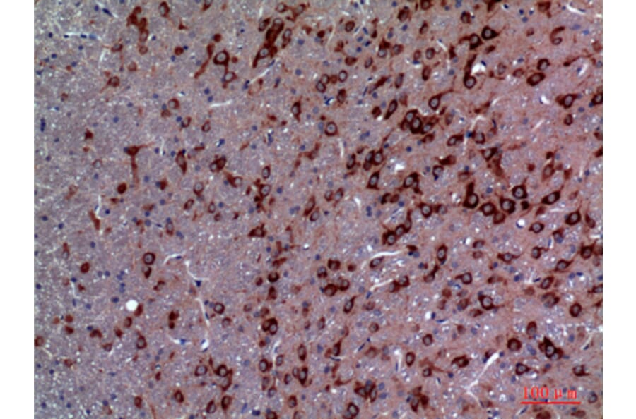 Immunohistochemistry - Anti-TRPC3 Antibody (C30186) - Antibodies.com