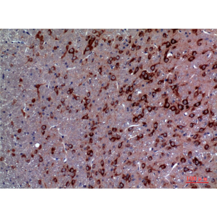 Immunohistochemistry - Anti-TRPC3 Antibody (C30186) - Antibodies.com