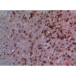 Immunohistochemistry - Anti-TRPC3 Antibody (C30186) - Antibodies.com