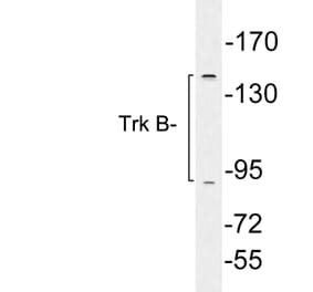 Western Blot - Anti-Trk B Antibody (R12-2390) - Antibodies.com