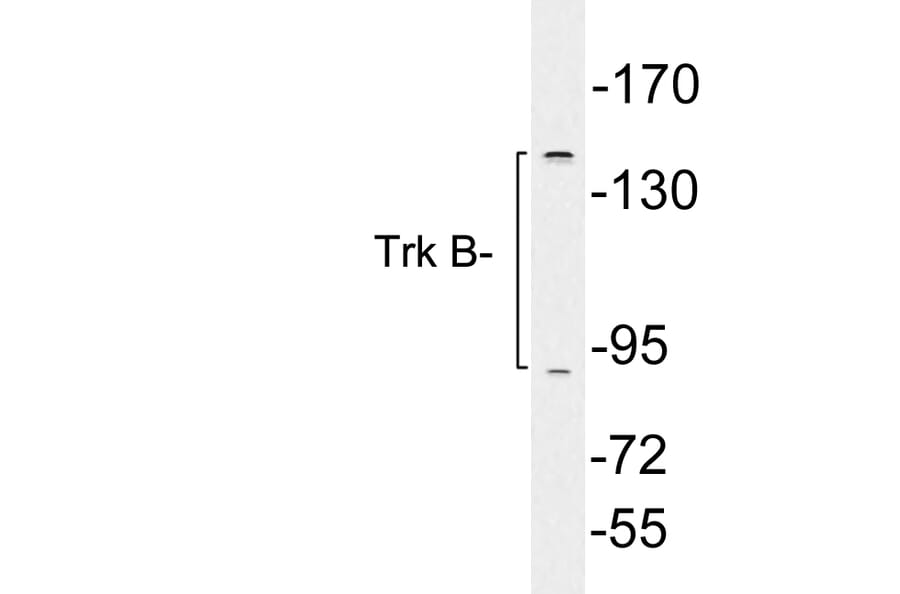 Western Blot - Anti-Trk B Antibody (R12-2390) - Antibodies.com