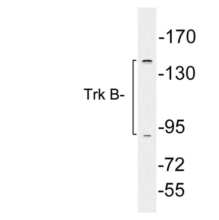 Western Blot - Anti-Trk B Antibody (R12-2390) - Antibodies.com