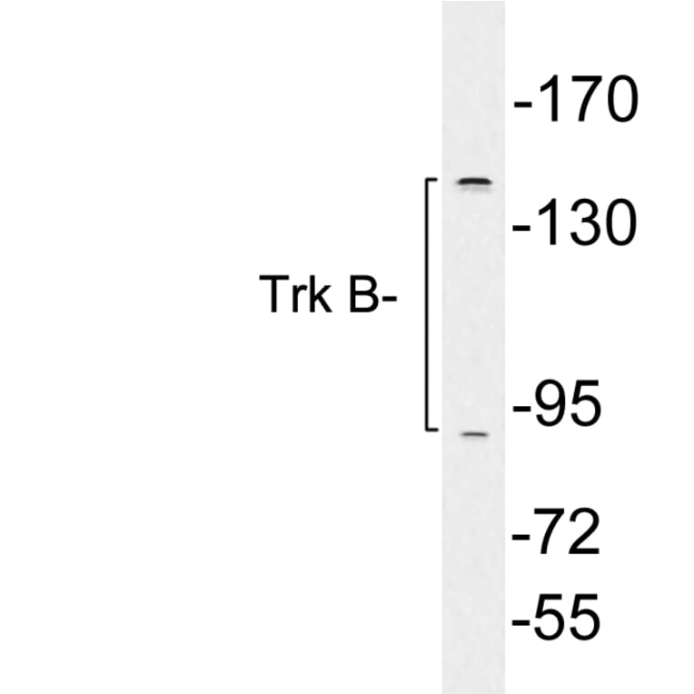 Western Blot - Anti-Trk B Antibody (R12-2390) - Antibodies.com