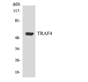 Western Blot - Anti-TRAF4 Antibody (R12-3647) - Antibodies.com