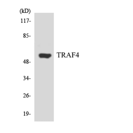 Western Blot - Anti-TRAF4 Antibody (R12-3647) - Antibodies.com