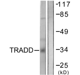 Western Blot - Anti-TRADD Antibody (C0377) - Antibodies.com