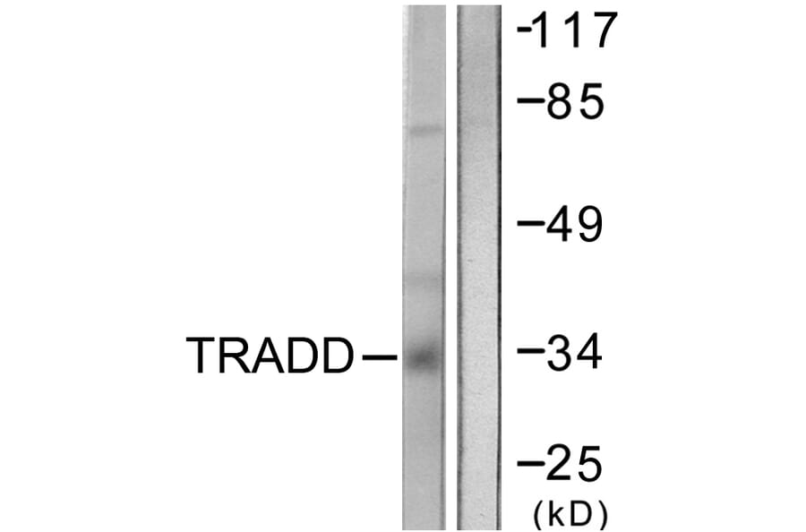 Western Blot - Anti-TRADD Antibody (C0377) - Antibodies.com