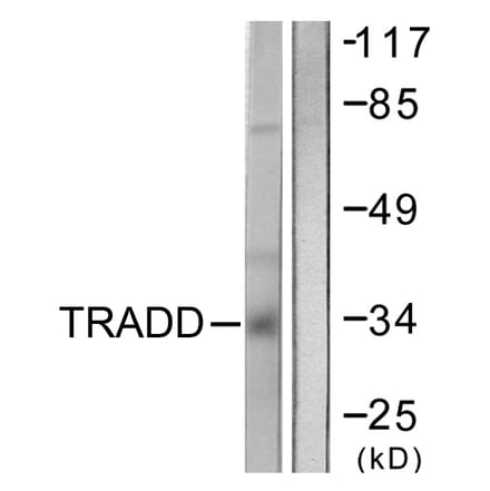 Western Blot - Anti-TRADD Antibody (C0377) - Antibodies.com