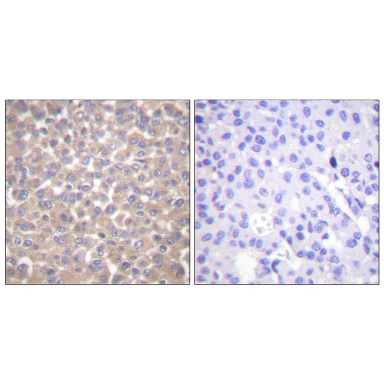 Immunohistochemistry - Anti-TRADD Antibody (C0377) - Antibodies.com