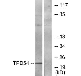Western Blot - Anti-TPD54 Antibody (C10100) - Antibodies.com