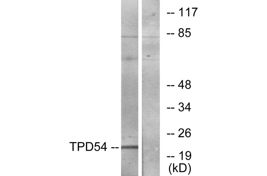 Western Blot - Anti-TPD54 Antibody (C10100) - Antibodies.com