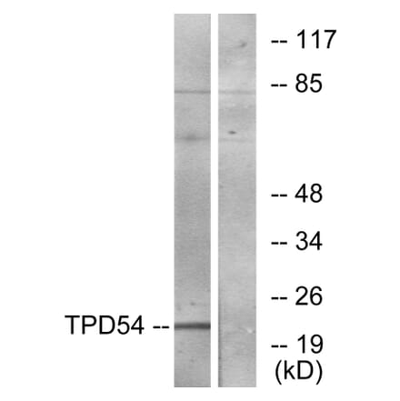 Western Blot - Anti-TPD54 Antibody (C10100) - Antibodies.com