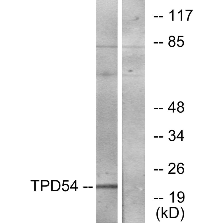 Western Blot - Anti-TPD54 Antibody (C10100) - Antibodies.com