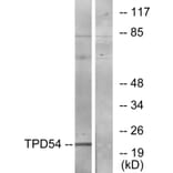 Western Blot - Anti-TPD54 Antibody (C10100) - Antibodies.com