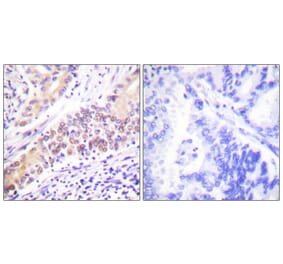 Immunohistochemistry - Anti-TOP2B Antibody (C0376) - Antibodies.com