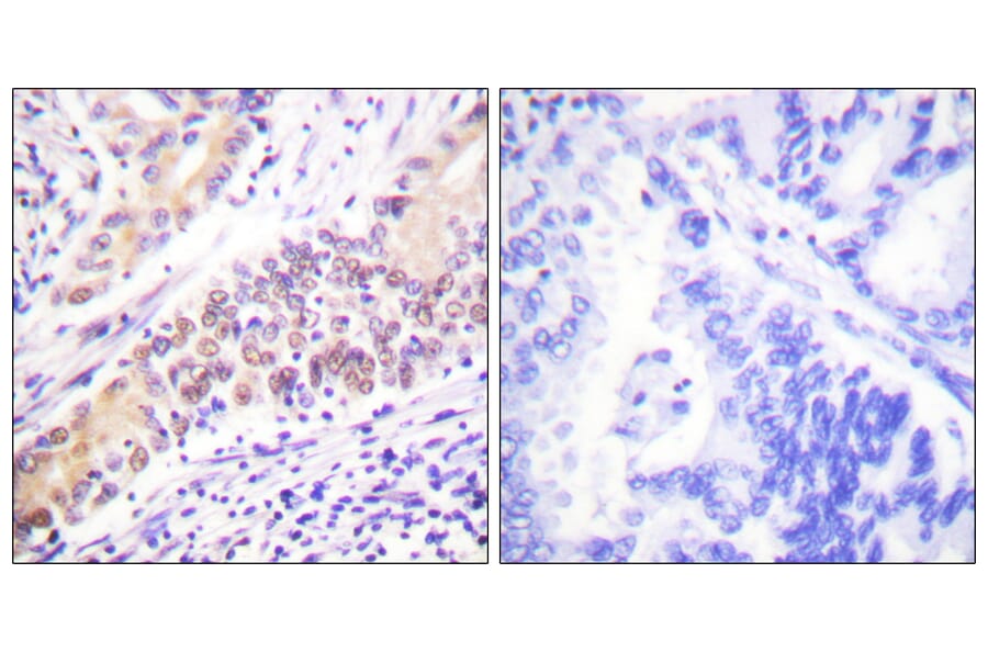 Immunohistochemistry - Anti-TOP2B Antibody (C0376) - Antibodies.com