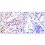 Immunohistochemistry - Anti-TOP2B Antibody (C0376) - Antibodies.com