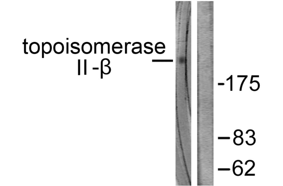 Western Blot - Anti-TOP2B Antibody (C0376) - Antibodies.com