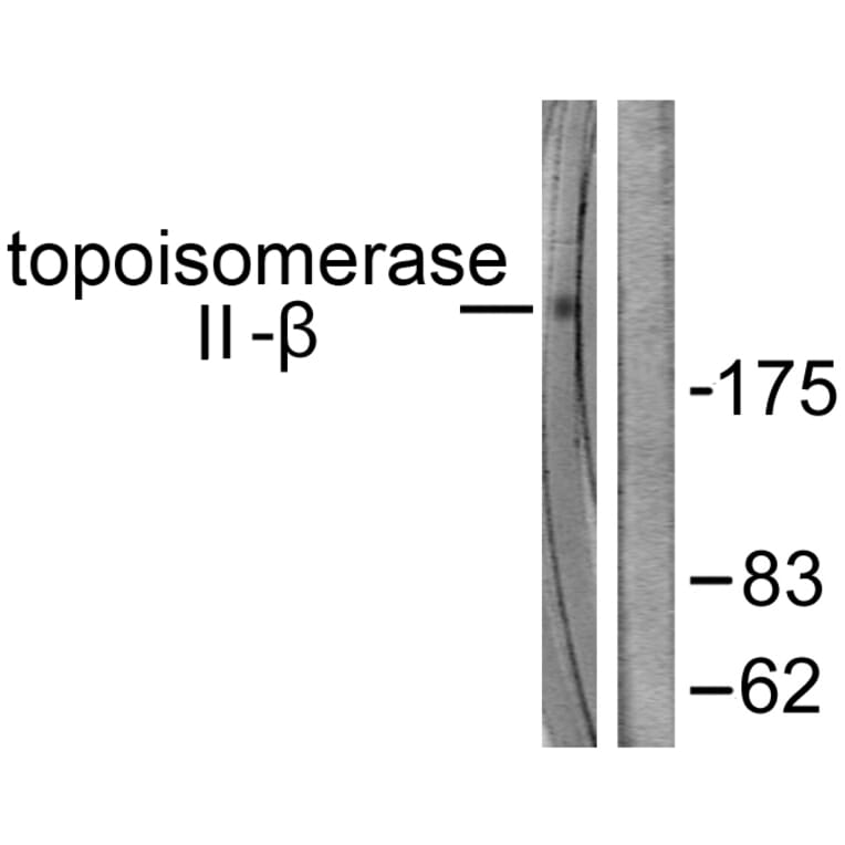 Western Blot - Anti-TOP2B Antibody (C0376) - Antibodies.com