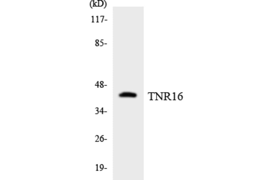Western Blot - Anti-TNR16 Antibody (R12-3640) - Antibodies.com