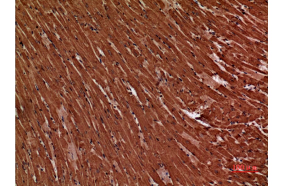 Immunohistochemistry - Anti-TNNT2 Antibody (C30058) - Antibodies.com