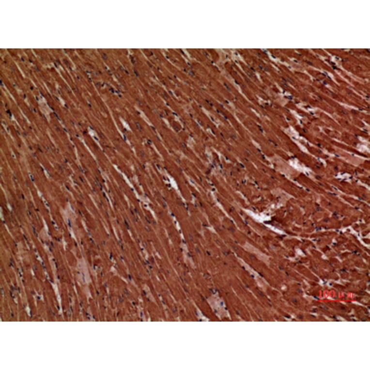 Immunohistochemistry - Anti-TNNT2 Antibody (C30058) - Antibodies.com