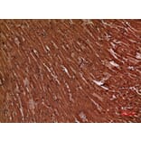 Immunohistochemistry - Anti-TNNT2 Antibody (C30058) - Antibodies.com