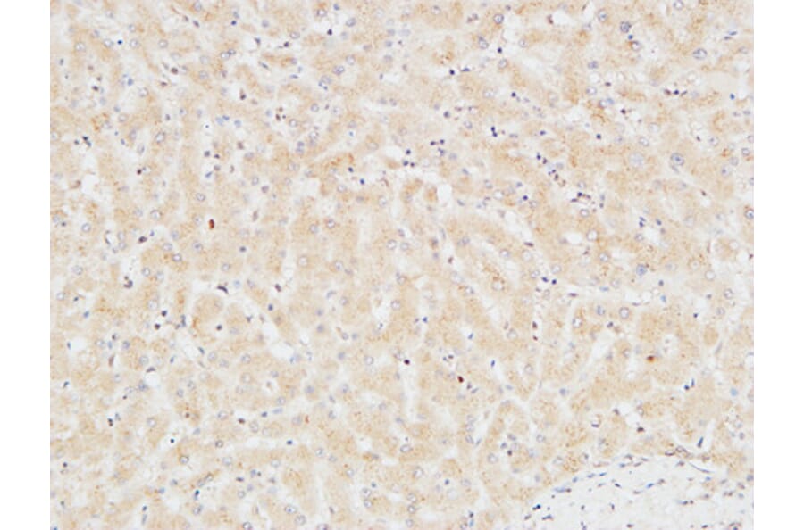 Immunohistochemistry - Anti-TNNT2 Antibody (C30058) - Antibodies.com