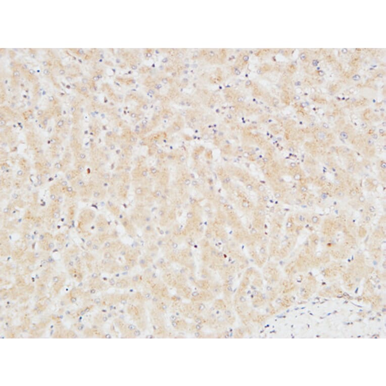 Immunohistochemistry - Anti-TNNT2 Antibody (C30058) - Antibodies.com